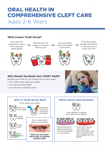 Comprehensive Cleft Care (口唇口蓋裂) Oral health in comprehensive cleft care | FDI